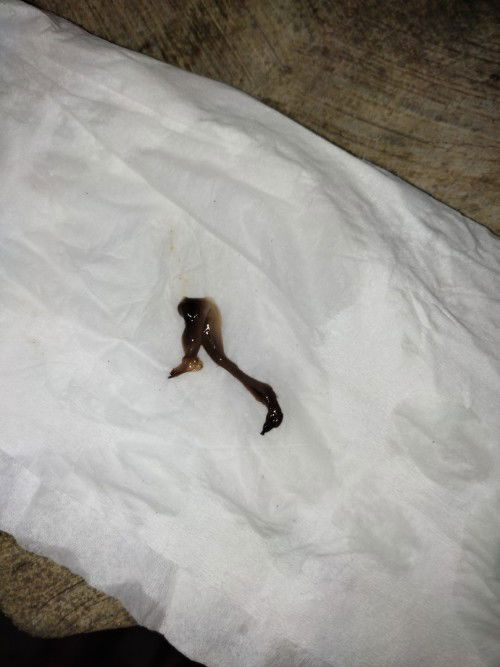 Flek kombinasi putih dan coklat