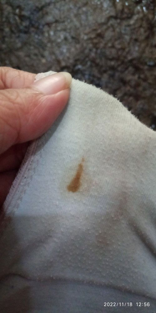 Spotting po ba to? 11 weeks pregnant po on my 3rd child. Ngayon ko lang po kse naencounter yan.