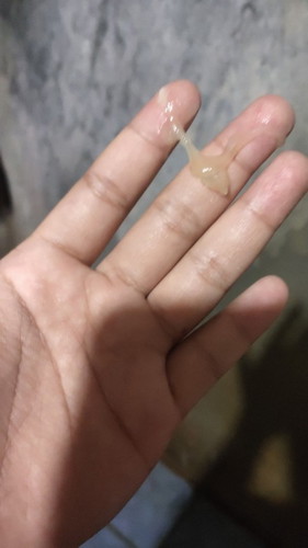 Keluar lendir