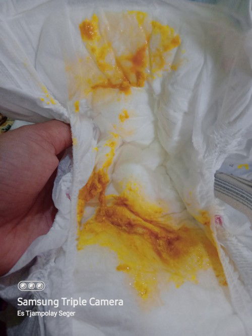 Pup bayi usia 1 bulan 20 hari full asi