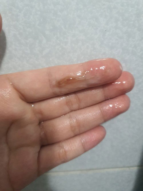 สอบถามค่ะมีมูกน้ำตาลกะสีขุ่นๆขาว