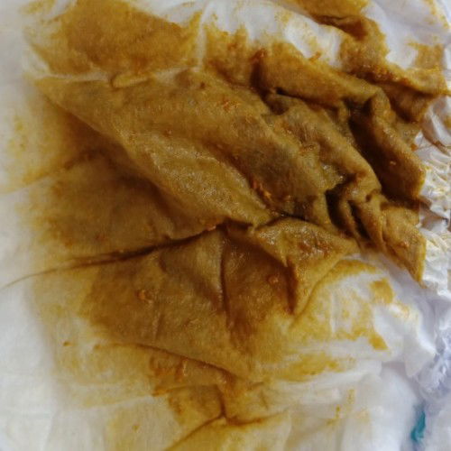 แพ้นมผงไหมค่ะถ่ายเป็นน้ำตลอดแบบนี้