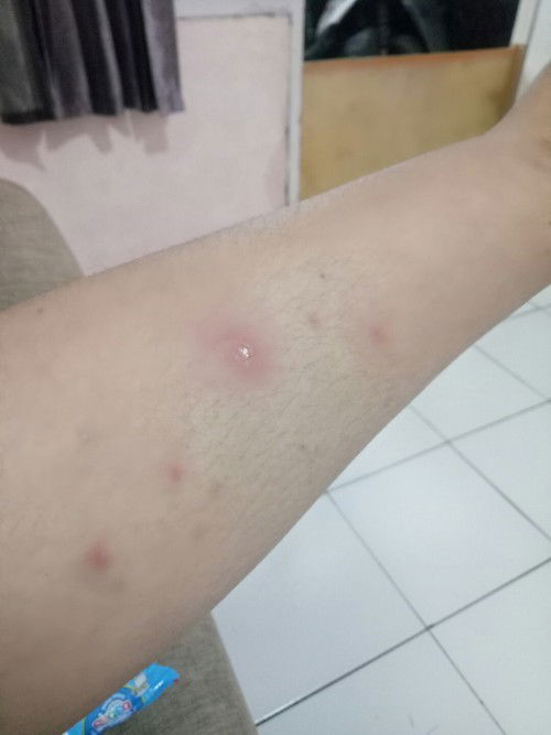 GATAL GATAL SAAT HAMIL