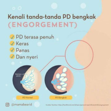 tentang PD