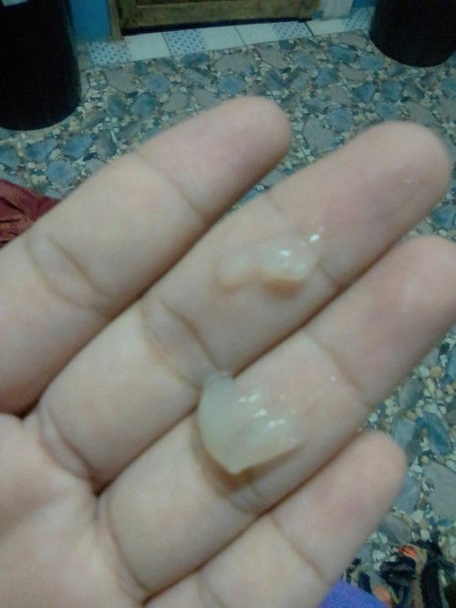 สอบถามแม่ๆหน่อยจร้าตอนนี้ท้องได้40+2วันแล้ว..วันนี้อาบน้ำแล้วมีมูกใส่ๆแบบนี้จะเป็นอะไรไหมคะ..ท้องแรก