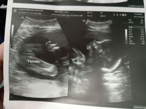 Baby Girl Name Suggestions