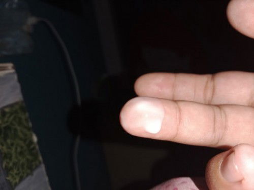 สอบถามหน่อยค่ะ ท้อง37+5