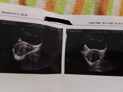 Tespek positif garis 2 tapi samar