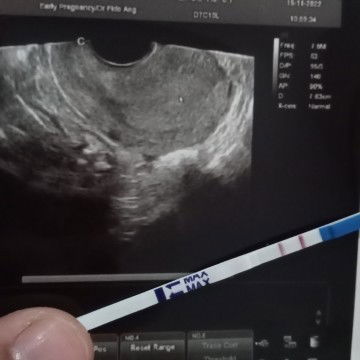 tanya usg kehamilan