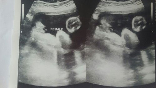 Baby's gender