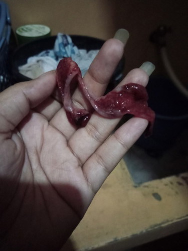 ANO PO ITO