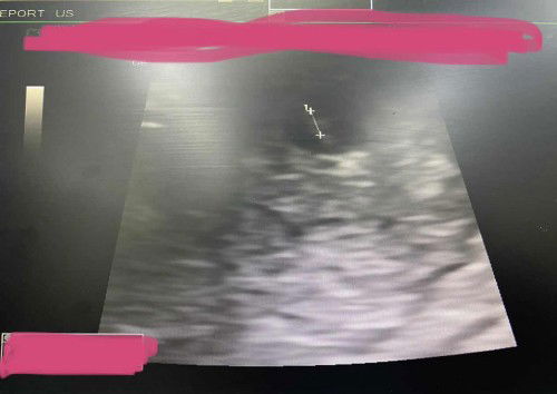 ไปตรวจกับคุณหมอ สรุปน้องมาแล้วจริงๆเลยค่ะ