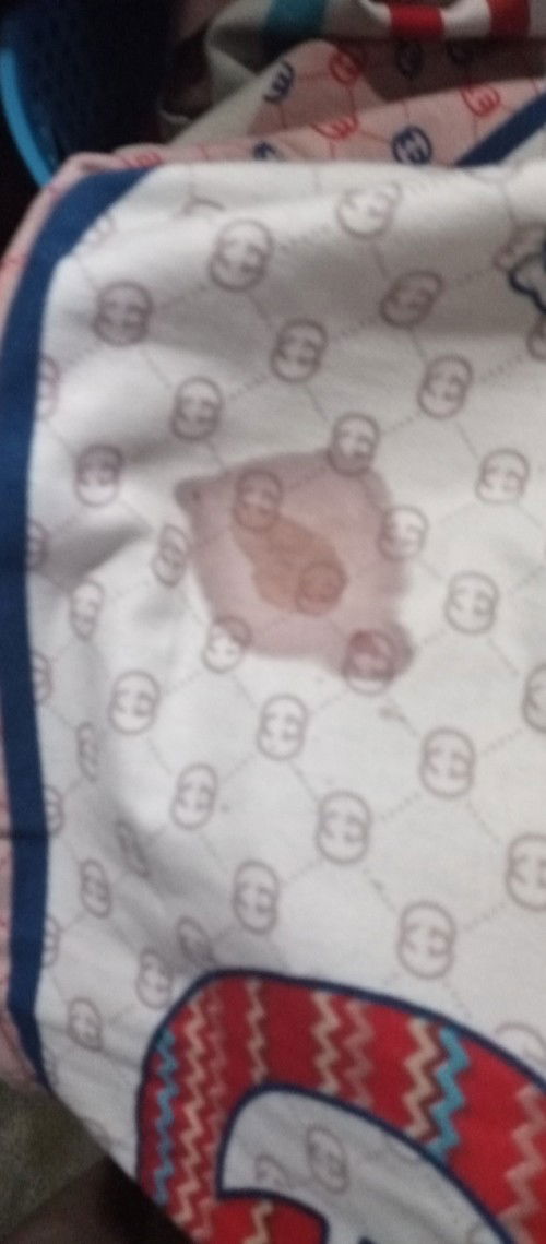 Sex during pregnant.