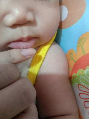 Anu po yung puti sa labi ni baby