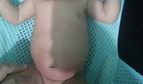Tummy ni baby