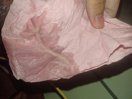 Mucus plug ke keputihan?