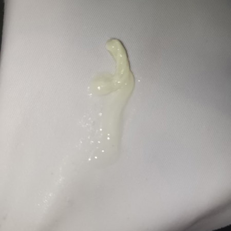 White Discharge. Normal ?