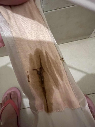 MUCUS PLUG???