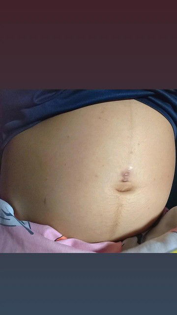 ท้องแบบนี้ผู้หญิงหรือผู้ชาย