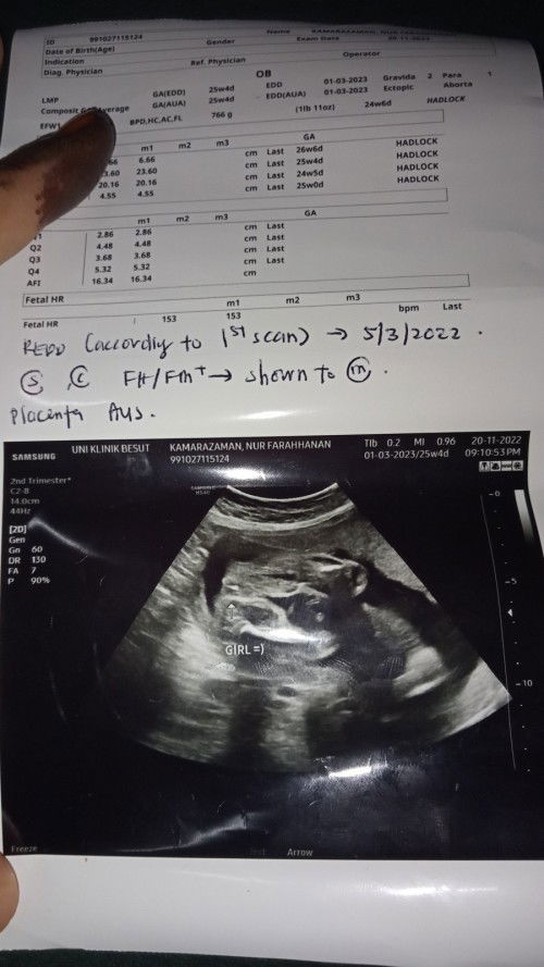 Nampak boy ke girl mommy semua?