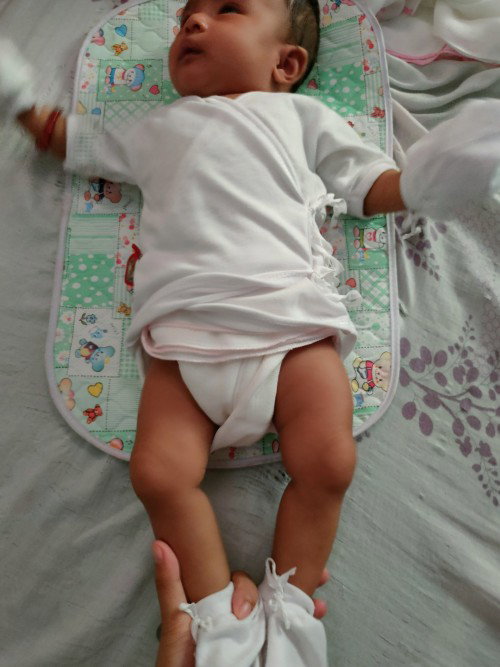 normal lng po ba na mamaga yong hita ni baby sa my pinag turokan 5 days na sya maga at parang mtigas