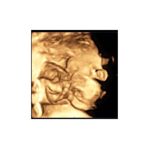 ซาวด์4Dก่อนคลอดตรงปกไหม