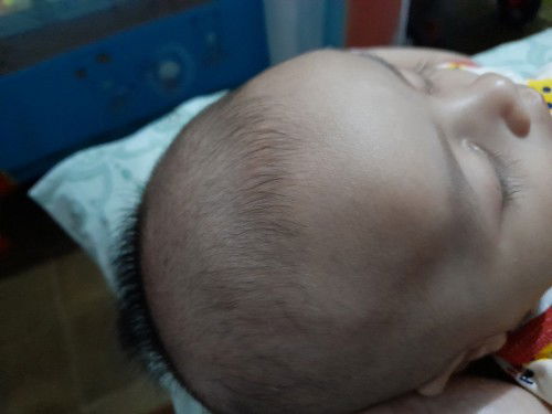 rambut bayi