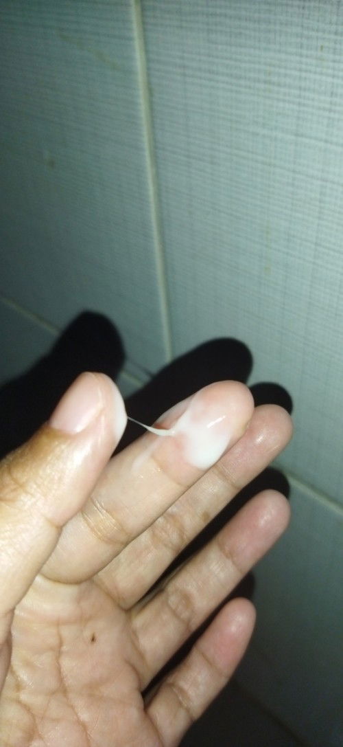 Keputihan putih susu telat haid