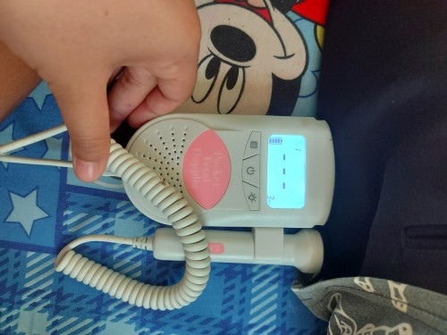 ส่งต่อเครื่องฟังเสียงหัวใจลูก