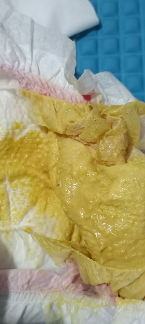 Normal poop po ba to ng mag 3mon old baby? Formula feed po.