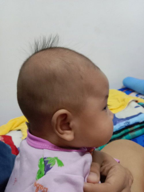 หัวแบบนี้แบนไหม