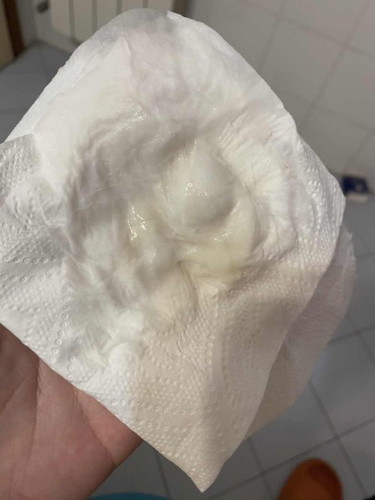 ตั้งครรภู 37+2 สัปดาห์