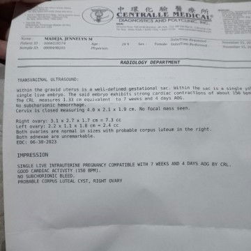 Sino po Ang may same case ko sa transv