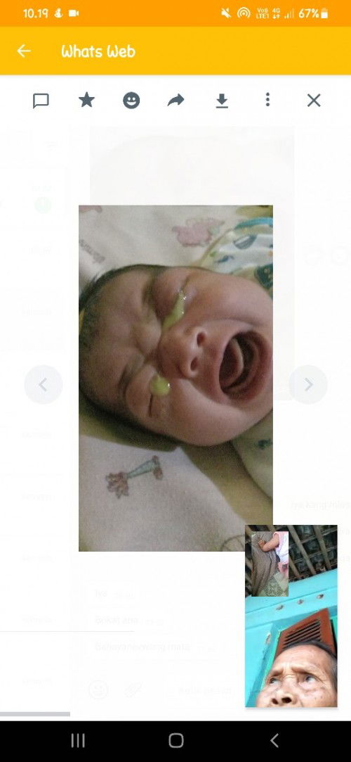 Bun, ada yg ngalamin anaknya kya gini? Klo nangis keluar nanah. Bayi baru lahir.