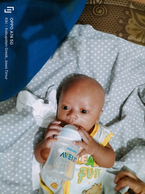 Beruntusa pada bayi usia 1bulan