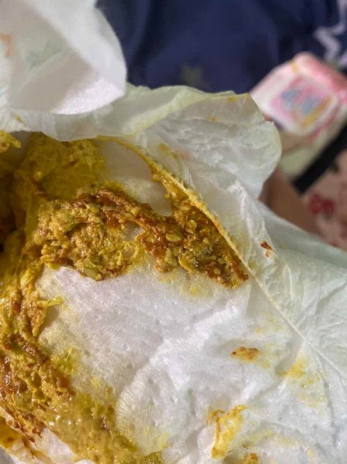 สอบถามค่ะเรื่องอึของน้อง