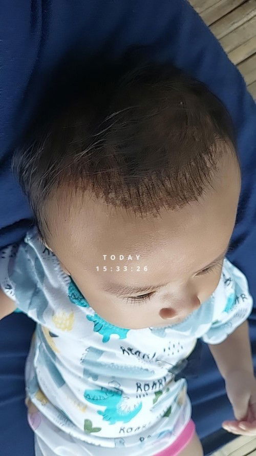 Ada yang tau ini kenapa bun jidatnya dan apa ya yg di kepala nya