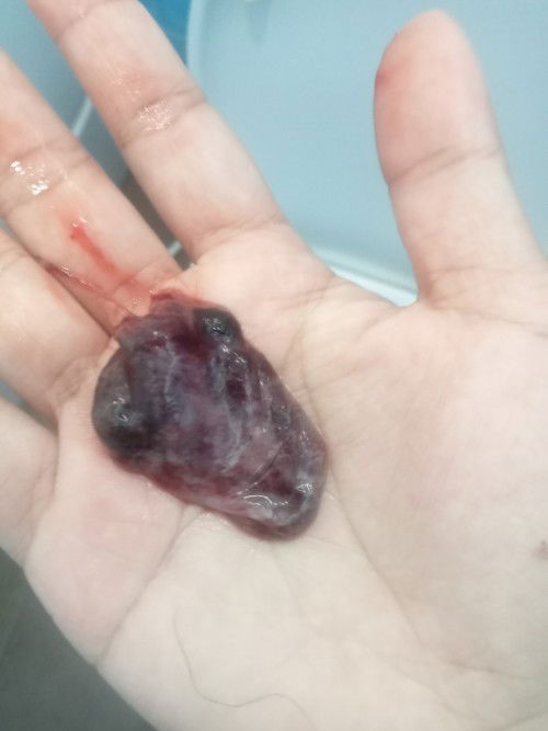 แท้งลูกไหมค่ะแบบนี้