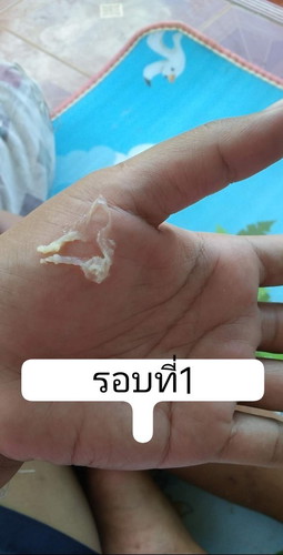 อยากสอบถามแม่ตอนนี้อายุครรภ์ได้40+3w มีมูกไหลออกมาทั้งปั่นบ่อย.น่วงๆท้อง อาการแบบนี้มีอันตรายไหม