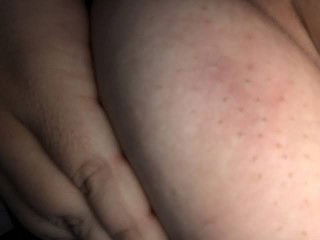 BREAST DISCOLORATION AND LUMPS