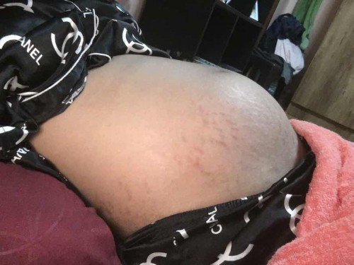 รักษารอยแตก