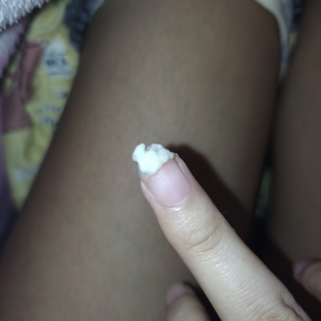 ANO PO KAYA ITO ? NORMAL PO BA ITO?