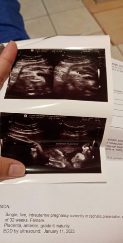 Mga mi ung black na image dku matanto kung mata ba un ni baby oh ano😁 maliit daw sya full face yan