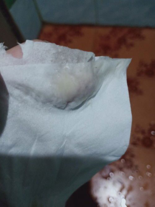 อันนี้เป็นมูกหรือตกขาวคะ