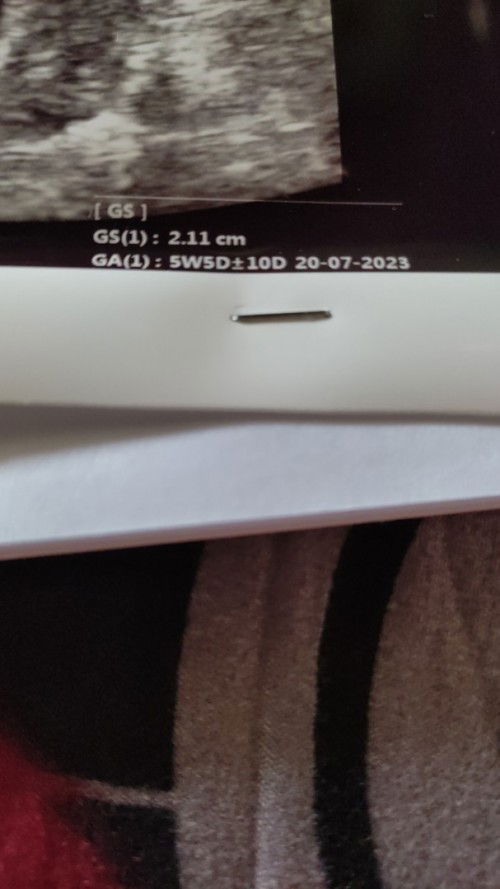 Kemarin dokter tidak menjelaskan dan sy juga lupa bertanya. Hari pertama terakhir halangan 25septmbr