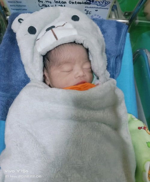 Alhamdulillah telah lahir anak saya laki laki secara SC usia kandungan 37minggu☺️