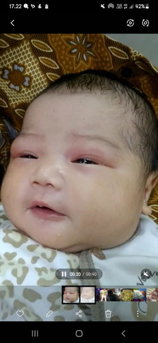 Buat bunda² makasih atas doanya ya bun, sekarang dedenya lekas membaik🥰 udah mulai buka mata.
