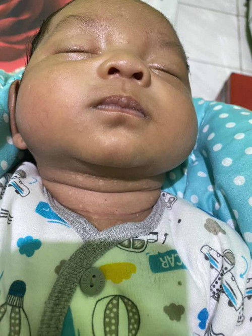 Leher bayi 1 bulan bintik bintik