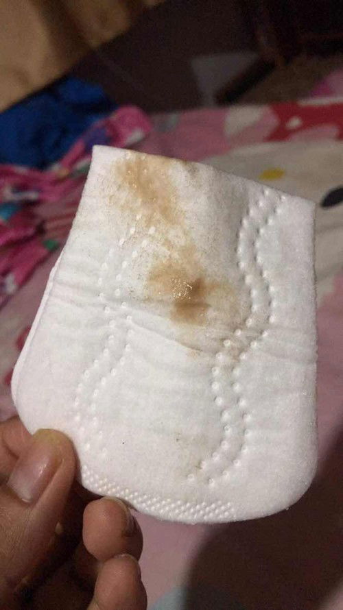 มีตกขาวออกแบบนี้เป็นอะไรไหมค่ะออกไม่เยอะ