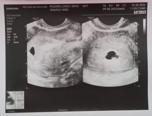 5 Weeks and 4 days